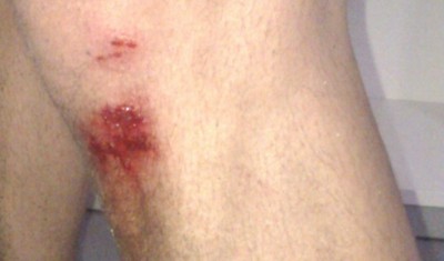 Knie.jpg